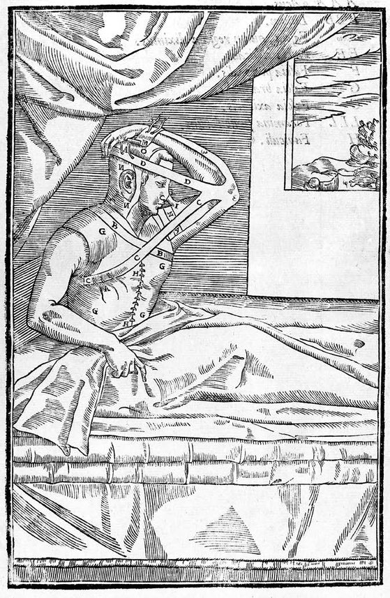 책엔 성형수술의 역사도 나온다. 사진은 1460년의 코 재건 성형 수술 환자의 회복 중 삽화. 김영사 제공