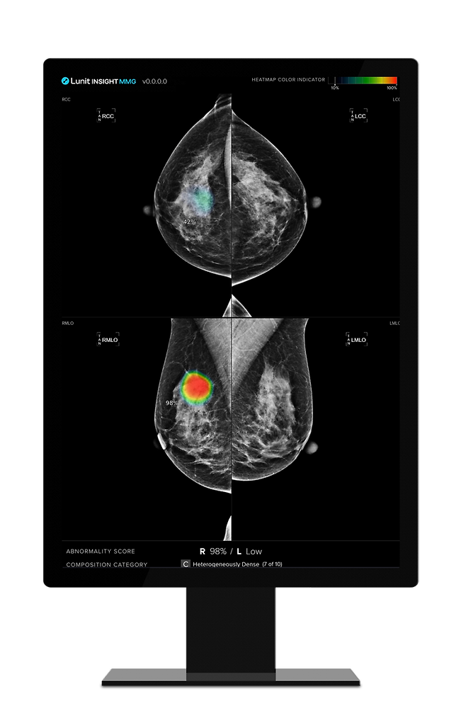 루닛의 유방촬영술 인공지능(AI) 영상진단 솔루션 '루닛 인사이트 MMG'. 루닛 제공