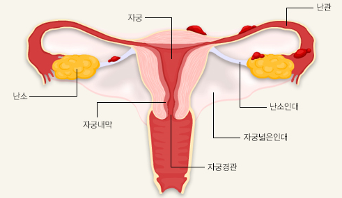 자궁내막조직이 자궁이 아닌 다른 곳에서 자라는 질환인 자궁내막증 가운데 난소에 발생하는 경우는 자궁내막종이라 부른다. 국가건강정보포털 제공