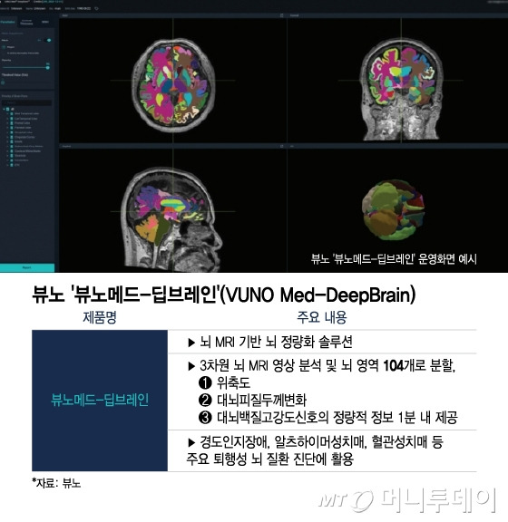 뷰노 '뷰노메드-딥브레인'(VUNO Med-DeepBrain). /사진=이지혜 디자인기자