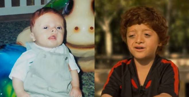 말론은 세이트리 챠즌 증후군 때문에 ​남들보다는 성장 속도는 느리지만, 여러 번의 수술 후 또래 아이들처럼 축구를 하고 학교에 다닐 수 있을 정도로 회복했다.​/사진=유튜브 채널 'UCSF Benioff Children’s Hospital Oakland'