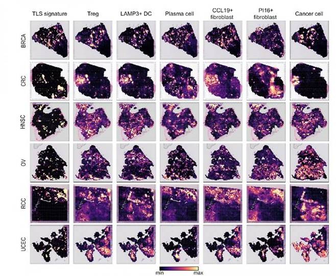 다양한 암종에서 관찰한 3차 림프 구조와 구성 세포의 공간적 배열 양상. KAIST