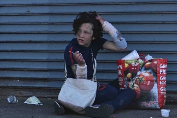 미국 펜실베이니아주 필라델피아 켄싱턴 거리의 한 여성이 퉁퉁 부은 손으로 주사기를 들고 있다. 그의 양팔에는 마약 중독 영향으로 썩어버린 피부를 보호하기 위한 붕대가 감겨있다.