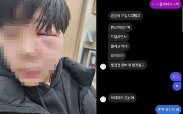 폭행으로 망막이 훼손된 학생 얼굴. [사진=연합뉴스]