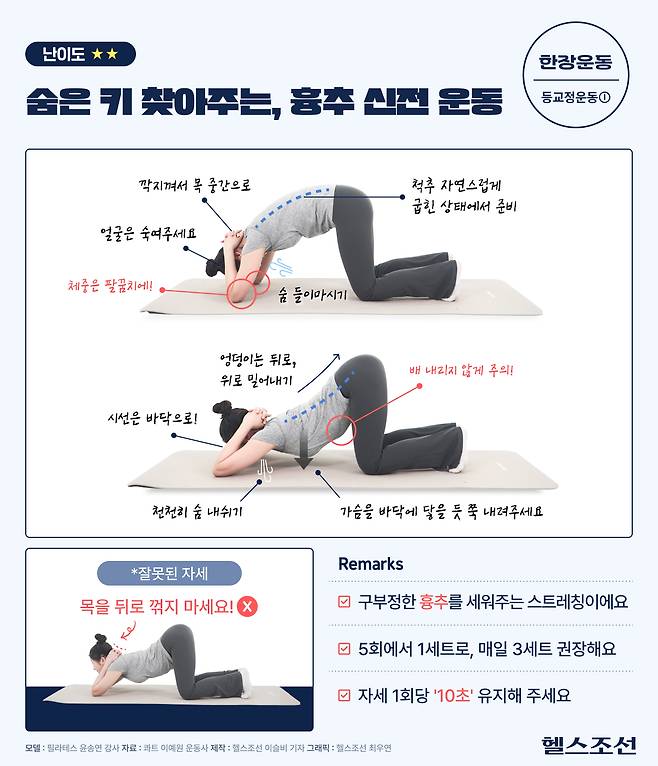 사진=헬스조선 DB