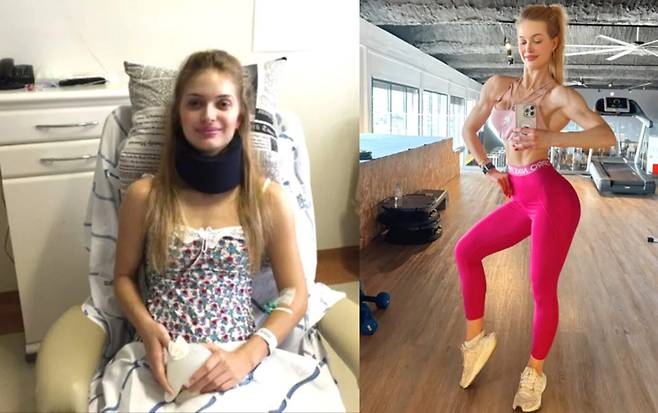 목 아래로 몸을 움직일 수 없었던 마르셀은 이제 챔피언이 되어 이제는 곧 다가올 조 와이더의 올림피아 아마추어 포르투갈 대회에 참가할 준비도 하고 있다. [사진=영국 일간 더선 보도 갈무리]