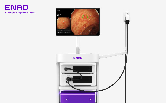 AI 위·대장내시경 병변검출 솔루션 '에나드'/사진제공=아이넥스