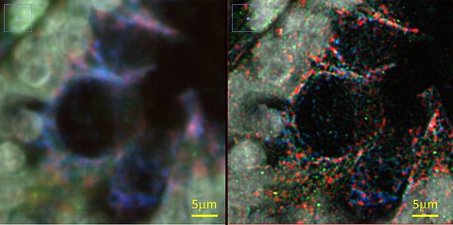 리버스바이오시스템스의 핵심 기술인 이미징 기술의 해상도 향상 효과. 일반 광학현미경(왼쪽)과 리버스바이오시스템스의 기술을 이용해 소장 조직 샘플을 촬영한 장면(오른쪽). 세포 내 소기관인 소포체, 미토콘드리아를 형광 이미징했다.  리버스바이오시스템스