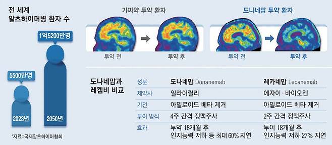 알츠하이머 치매 환자의 뇌 양전자방출단층촬영(PET) 모습. 붉은색과 녹색, 노란색으로 보이는 부분이 아밀로이드 베타 단백질 덩어리다. 치료제 투약 후 줄어든 것을 볼 수 있다. 치료제를 투약하지 않은 환자는 변화가 없었다.  일라이릴리