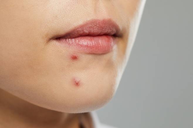 사진=게티이미지뱅크