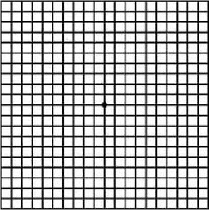 30~40cm 떨어진 곳에서 선이 휘거나 희미하게 보인다면 황반변성일 수 있다. / 사진= 헬스조선DB