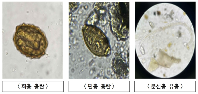 북한이 살포한 오물풍선 안에서 발견된 기생충들. 통일부는 기생충들이 인분으로부터 유래됐을 가능성을 보여준다고 밝혔다. 화학비료 대신 인분비료를 사용하는 등 주로 보건환경 후진국에서 식별되는 모습이다. / 사진=통일부