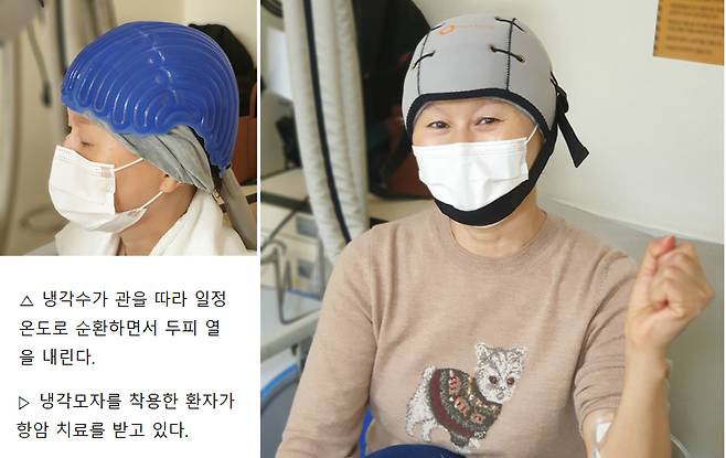 암 환자가 냉각모자를 착용한 모습. /사진=삼성서울병원