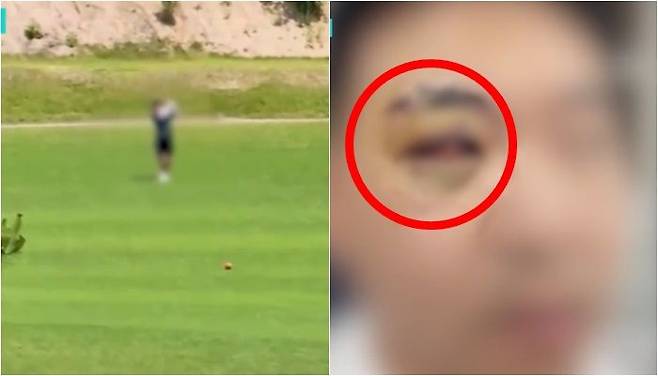 /사진=SBS 보도 화면 캡처