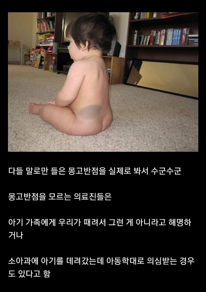 image.png 미국 소아과, 산부인과 의사들이 동양인 아기 보면 기겁하는 이유