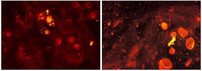 소마젤란운의 가스 구름(왼쪽)과 결핵균(오른쪽)이다. 사진 속에 담긴 소마젤란운 영역은 7천광년(1448조km), 결핵균은 길이 0.000002~0.000004m다. 나사 제공