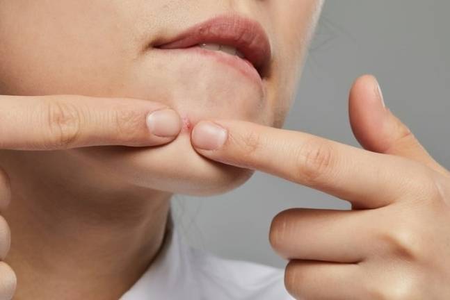 샴푸의 파라벤이나 알코올 등의 화학성분이 피부에 닿으면 피부 트러블을 유발한다. 게티이미지