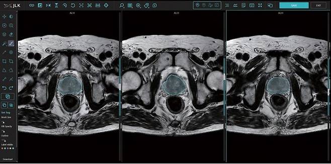 제이엘케이의 전립선암 인공지능 솔루션 'MEDIHUB Prostate' (자료=제이엘케이 제공) *재판매 및 DB 금지