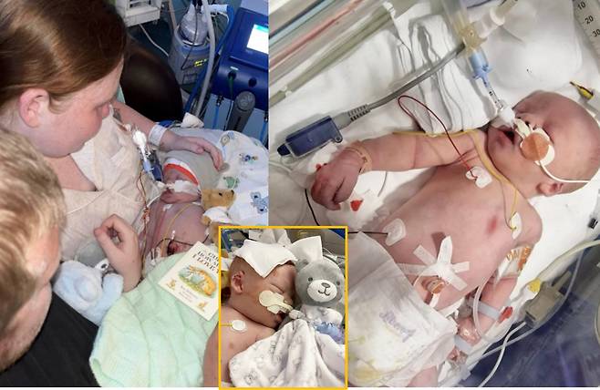 한 신생아가 출생 중 산소 부족으로 사망한 가운데 아기가 호흡을 잃는 동안 간호 직원들은 앉아서 젤리를 몇 개나 먹었는지, 얼마나 돈을 벌었는지에 대해 농담을 하고 있었다는 사실이 밝혀져 논란이 일고 있다. 테오가 세상을 떠나기 전 모습들. [사진= 영국 일간 더선 보도 갈무리]