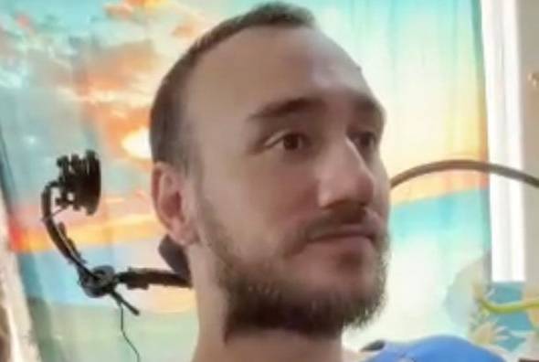 뉴럴링크의 칩을 뇌에 이식한 놀런드 아르보.