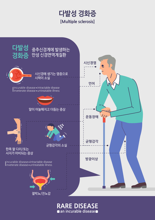 다발성경화증은 주로 20~40대의 꽃다운 나이를 노린다. 위험 요인을 없애 예방에 힘쓰고, 증상이 나타나면 반드시 6개월 안에 치료를 시작해야 한다. [사진=게티이미지뱅크]