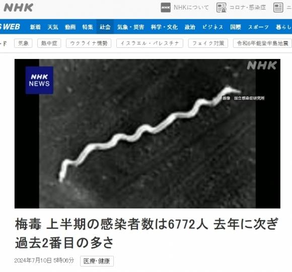 일본 NHK 10일자 보도 캡처