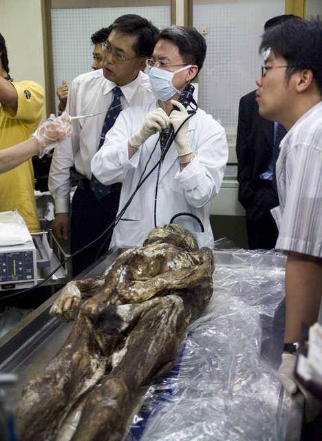 2004년 7월 21일 고대 안암병원 병리학교실 김한겸 교수팀이 대전 중구 목달동에서 발견된, 600년 전에 사망한 것으로 추정되는 '미라'의 내시경 검사를 하고 있다. 20년이 지난 20일 김 교수는 특강에서 "우리나라 미라는 이집트 미라와 달리 몸속에 습기가 있어서 내시경 검사가 가능하다"고 말했다. 연합뉴스