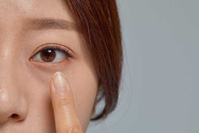 잠을 충분히 자도 다크서클이 사라지지 않는다면 색소 침착, 눈 밑 지방, 비염 등이 원인일 수 있다./사진=게티이미지뱅크