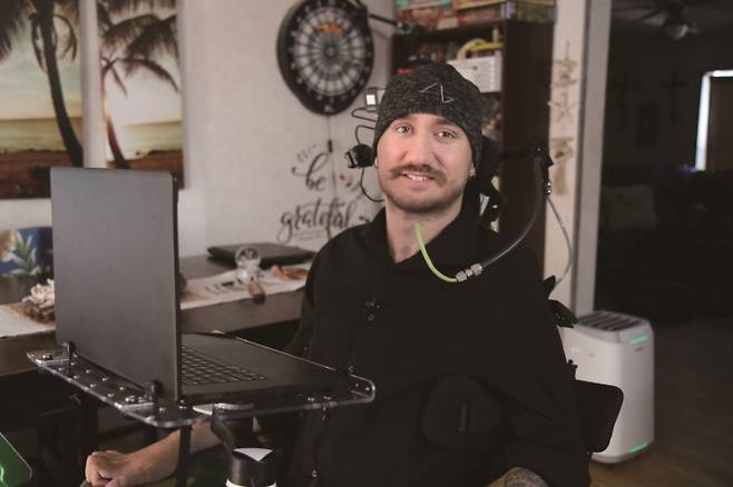 뉴럴링크의 첫 임상시험 참가자 놀란드 아르보. 1월 29일 뇌에 뉴럴링크의 N1 임플란트 칩을 삽입하는 수술을 받았다. 칩은 뇌파를 읽어 컴퓨터 커서를 움직인다. 과학동아 제공