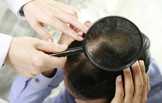 효과적인 탈모치료를 위해서는 치료 약물의 차이점을 알아둬야 한다｜출처: 클립아트코리아