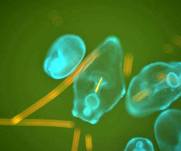 바다의 열대우림으로 불리는 산호를 먹는 가시관 불가사리가 갑자기 늘어나고 있다. 투명한 몸 가운데 보이는 것이 가시관 불가사리이며, 노란색이 가시관 불가사리의 먹이인 트리코데스뮴이다. 출처: 벤자민 모스.