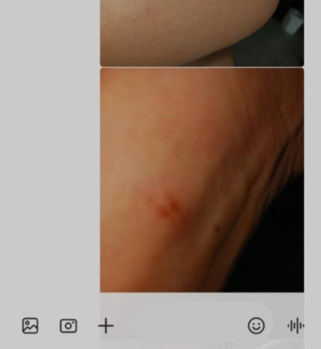 강씨가 11일 아파트 시설과장에게 보낸 폭행 흔적. 강씨 유족 제공