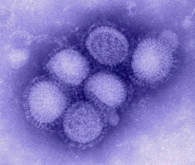 인플루엔자 바이러스의 전자현미경 사진. 성균관대 연구진은 바이러스가 사람 세포에 감염될 때 사용하는 수용체를 모방해 항바이러스제를 개발했다./미 질병통제예방센터