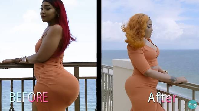 코트니 반스(35)는 22살에 처음 엉덩이 필러 시술을 받았지만, 부작용 때문에 필러를 제거했다. 제거하기 전후 사진.​​/사진=유튜브 채널 'truly'