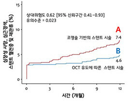 기존의 치료법(A)과 OCT 유도 중재술(B) 간 합병증 발생률 비교.