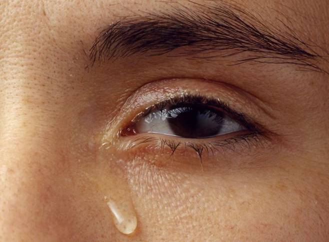 눈물이 너무 많이 생성되거나, 눈물길이 막히면 눈물 흘림증이 발생한다./사진=게티이미지뱅크