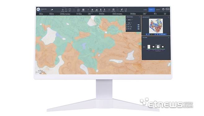 로슈진단 '네비파이 디지털 병리' 플랫폼에 통합된 루닛 AI 병리분석 솔루션 '루닛 스코프 PD-L1' (이미지제공=루닛)