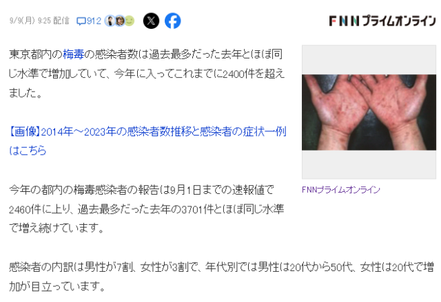 도쿄도 매독 기사를 보도한 내용. FNN캡처