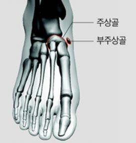 부주상골./사진=헬스조선 DB