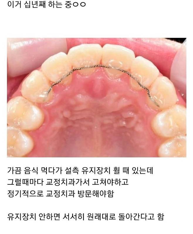 치아교정이 힘든이유