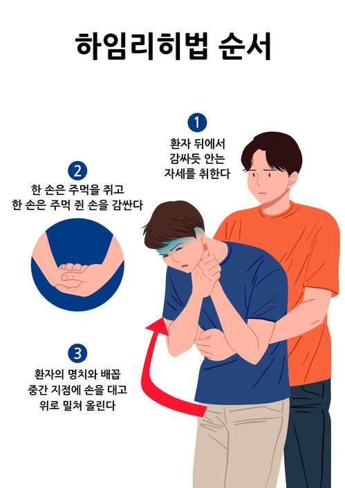 =성인에서 기도가 막혔을 땐 환자의 명치와 배꼽 중간 지점에 주먹을 대고 위로 밀쳐 올린다. [사진=게티이미지뱅크]