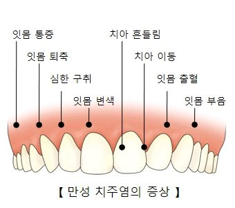 서울아산병원