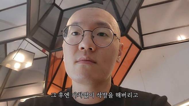 터키에 모발이식 수술 하러 간 탈모인