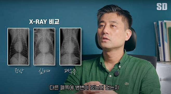 반려견 심장병의 진단은 보호자 문진과 신체검사, 엑스레이 검사, 초음파 검사를 통해 이뤄진다. (에스디동물의료센터 유튜브 채널 갈무리) ⓒ 뉴스1