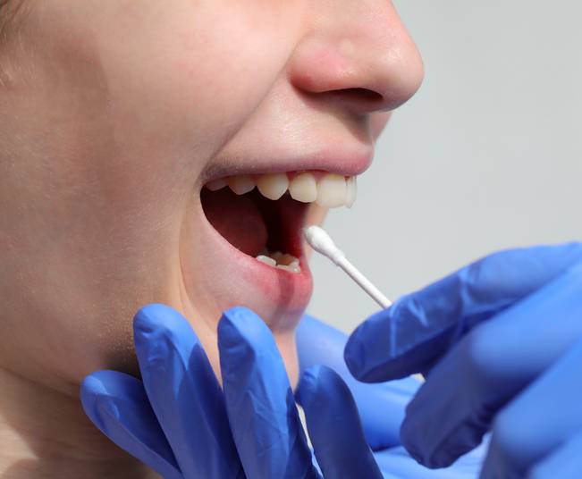 입안의 볼 쪽으로 면봉을 넣어 검사로 수명을 예측할 수 있다하여 '칙에이지(CheekAge)'로 명명된 이 검사법은 환경이나 생활방식이 유전자에 미친 영향을 감안하는 후성유전학에 기초한다. [사진= 게티이미지뱅크]