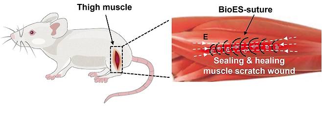 생체흡수성 전기자극 봉합사(BioES-suture) 치료 [Zhouquan Sun and Chengyi Hou 제공. 재판매 및 DB 금지]