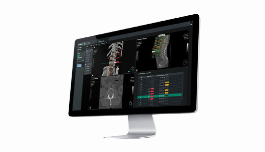 코어라인소프트의 AI 기반 척추 영역 분할 소프트웨어 'AVIEW SpineBH'. 코어라인소프트 제공.