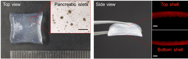 3D 프린팅 이식체의 이미지. 왼쪽부터 췌도 이식체 상단, 측면 및 바깥층 형광 측면 이미지. 울산과학기술원(UNIST) 제공