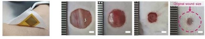 외부 전원 공급없이 밴드가 전기에너지를 방출해 상처 회복 속도를 높였다./사진=국제 학술지 ‘어드밴스드 머터리얼즈'​ 캡처