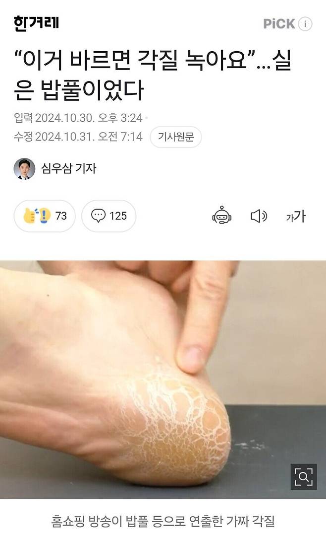 홈쇼핑에서 우수수 떨어지던 발 각질의 정체